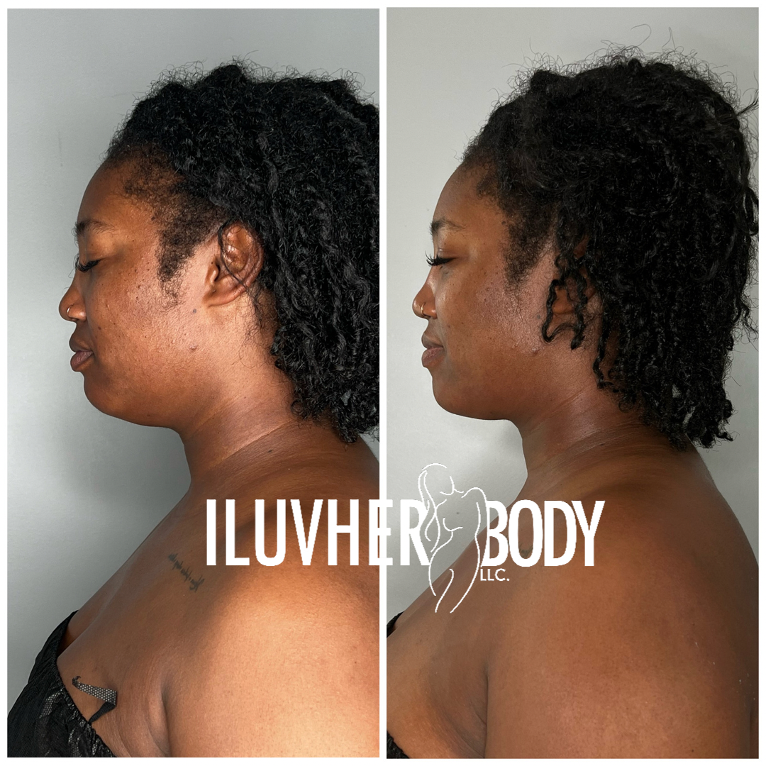 Tips for maintaining your body sculpting results over the long term